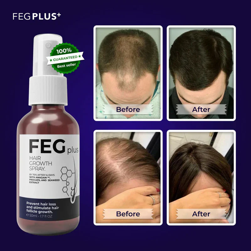 šEK K SAATH 1 MUFT LIMITED TIME OFFERš„Most Viral FEG Plus Hair Growth Spray - Image 2