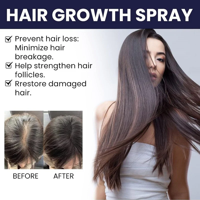 šEK K SAATH 1 MUFT LIMITED TIME OFFERš„Most Viral FEG Plus Hair Growth Spray - Image 3