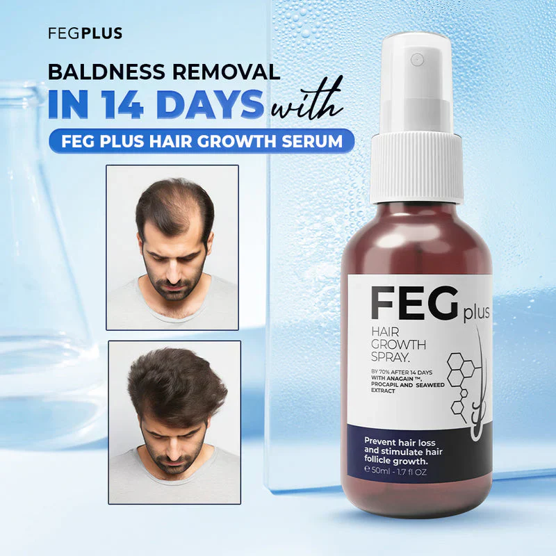 šEK K SAATH 1 MUFT LIMITED TIME OFFERš„Most Viral FEG Plus Hair Growth Spray - Image 5